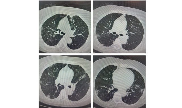 ÖZKAYA'DAN COVID-19 UYARISI: 'Bayramda toplu aktiviteler sizi hasta etmesin'