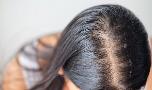 Uzmandan uyarı: 'Saçkıran' olabilirsiniz!