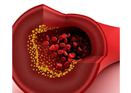 GİZLİ TEHLİKE: HİPERTANSİYON!