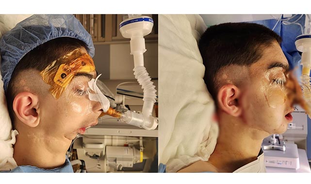 Çene ameliyatı ile hayat yeni bir başlangıç! 17 yıl sonra yemek yiyebilecek