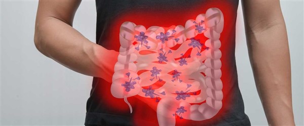 Kalın Bağırsak iltihabı nedir? Belirtileri ve tedavisi nasıldır?