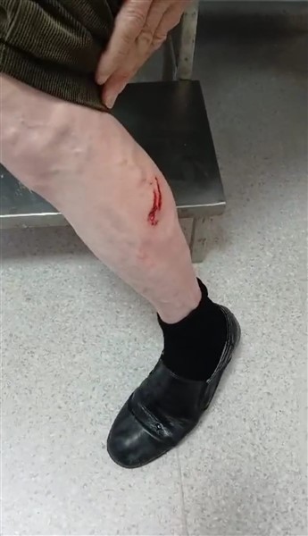 Samsun'da sokak köpekleri yaşlı adamı saldırdı