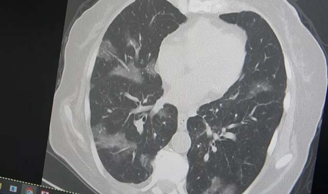 Profesör Şevket Özkaya'dan çok kritik varyant açıklaması! Bu yaza damgasını vuracak