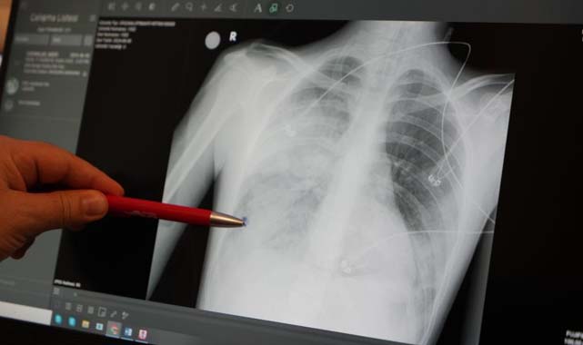 Şevket Özkaya uyardı: Klimalar zatürre yapıyor