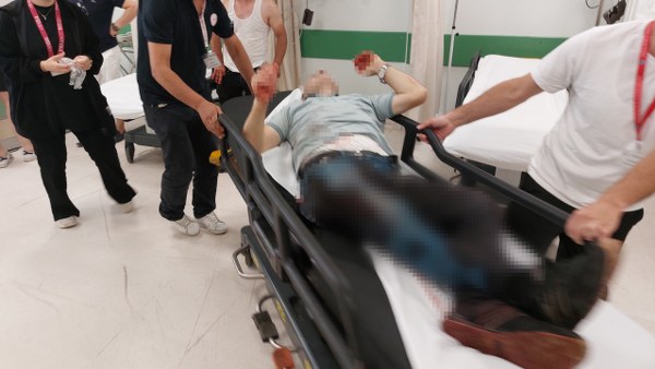 Samsun'da düğünde hayavaya ateş açan maganda kendini vurdu