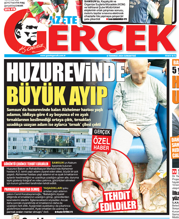 Samsun'da alzheimer hastası huzurevinde aylarca tırnak çilesi çekti