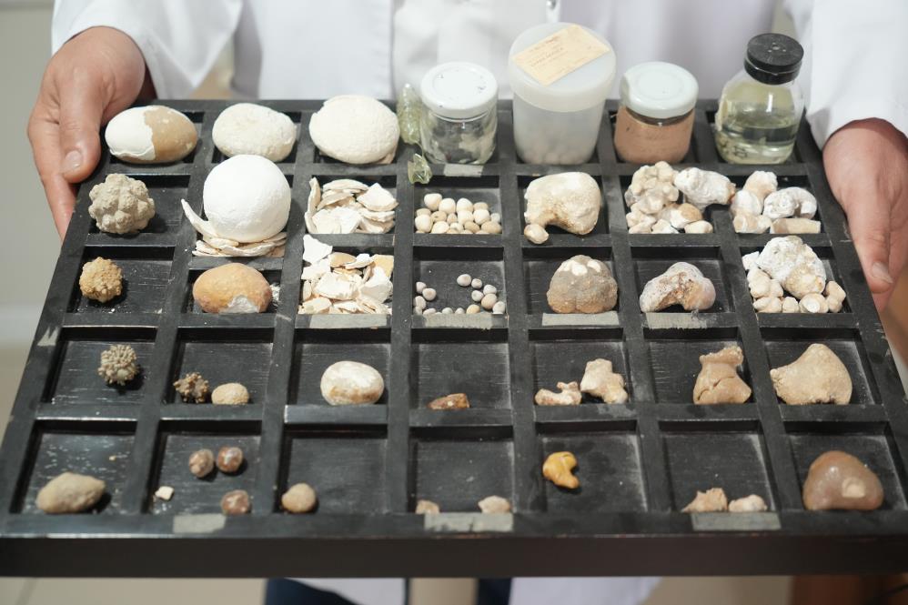Samsun'da hastaların taşları doktorun koleksiyonu oldu