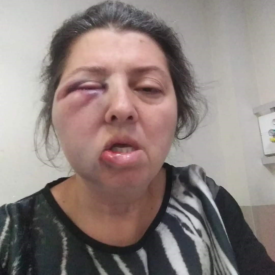 İstanbul Küçükçekmece'de hayvansever iki kız kardeş komşuları tarafından darp edildi