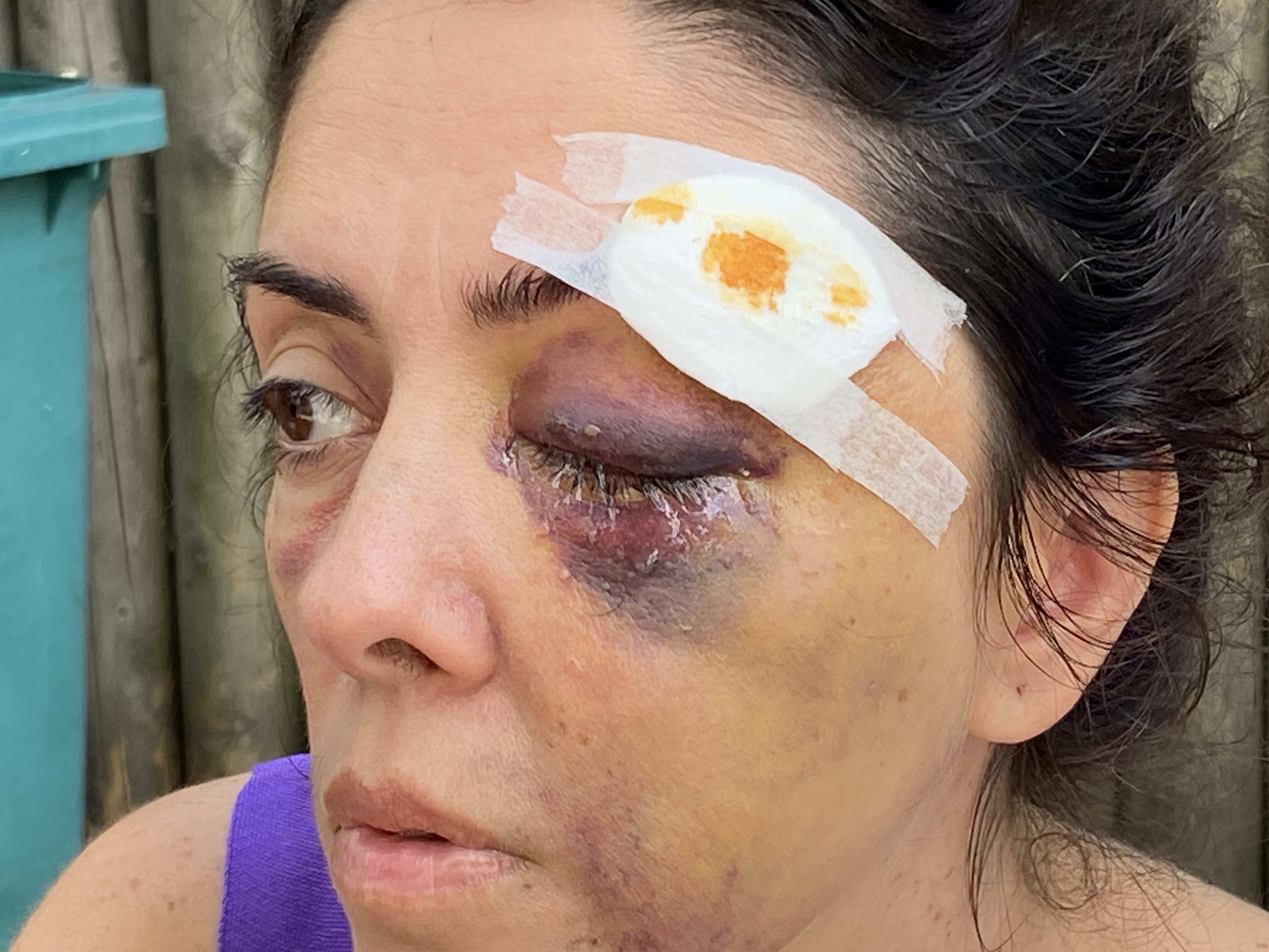 İstanbul Küçükçekmece'de hayvansever iki kız kardeş komşuları tarafından darp edildi