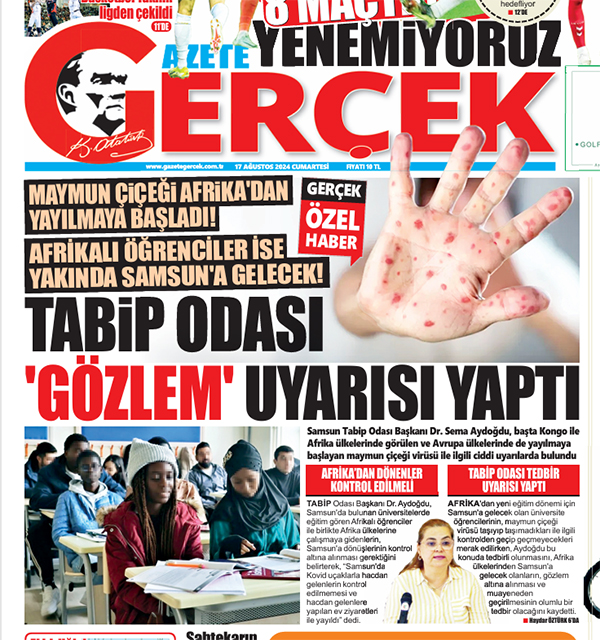 Samsun Tabip Odası'ndan Maymun Çiçeği uyarısı! Afrika'dan gelenler gözlem altına alınmalı