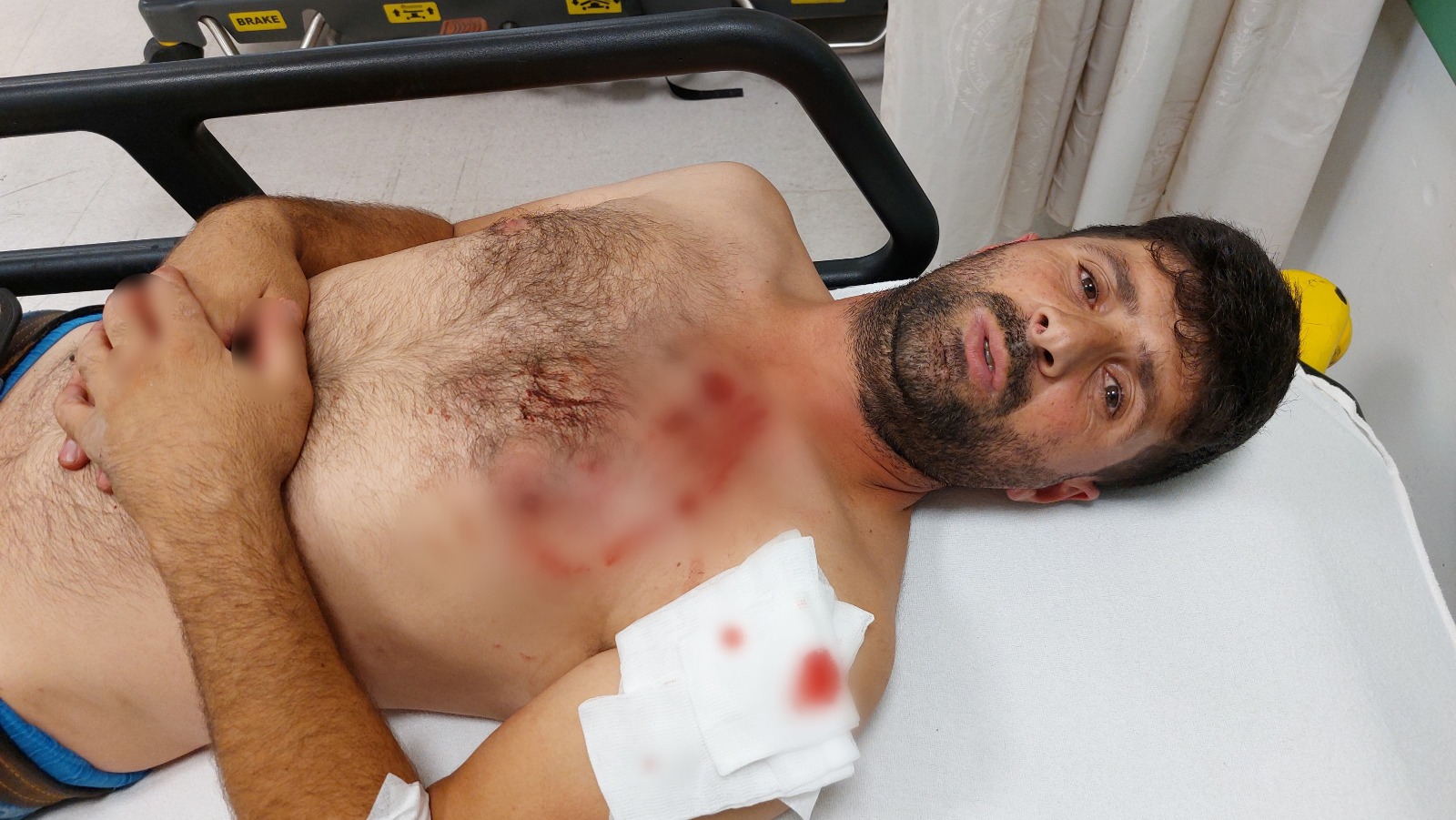 Samsun'da köpek saldırısı! Adam ölümden döndü