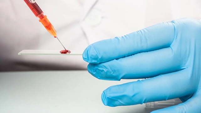 Yeni bir kan grubu keşfedildi! Keşfedilen grubun adı: MAL!