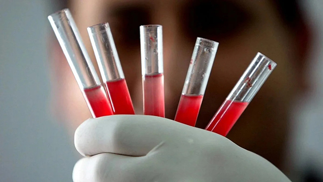 Yeni bir kan grubu keşfedildi! Keşfedilen grubun adı: MAL!