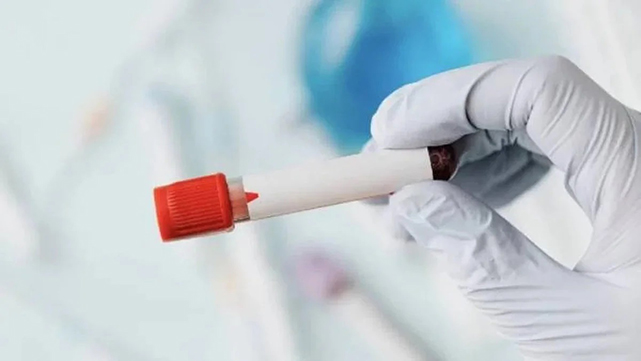 Yeni bir kan grubu keşfedildi! Keşfedilen grubun adı: MAL!