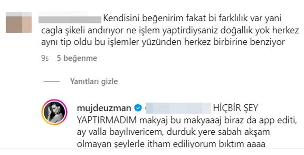 Müjde Uzman’dan estetik yorumlarına sert tepki: Bıktım ithamlardan