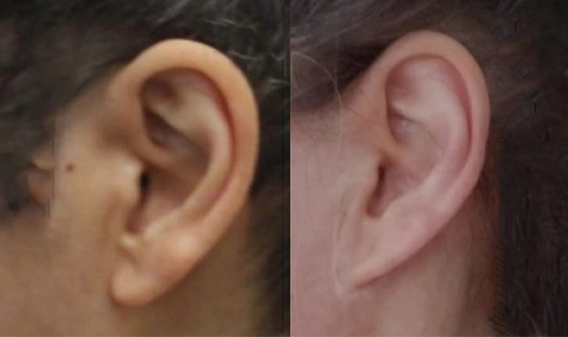 'Boyun gerdirdim, kulaklarım aşağı uzadı'