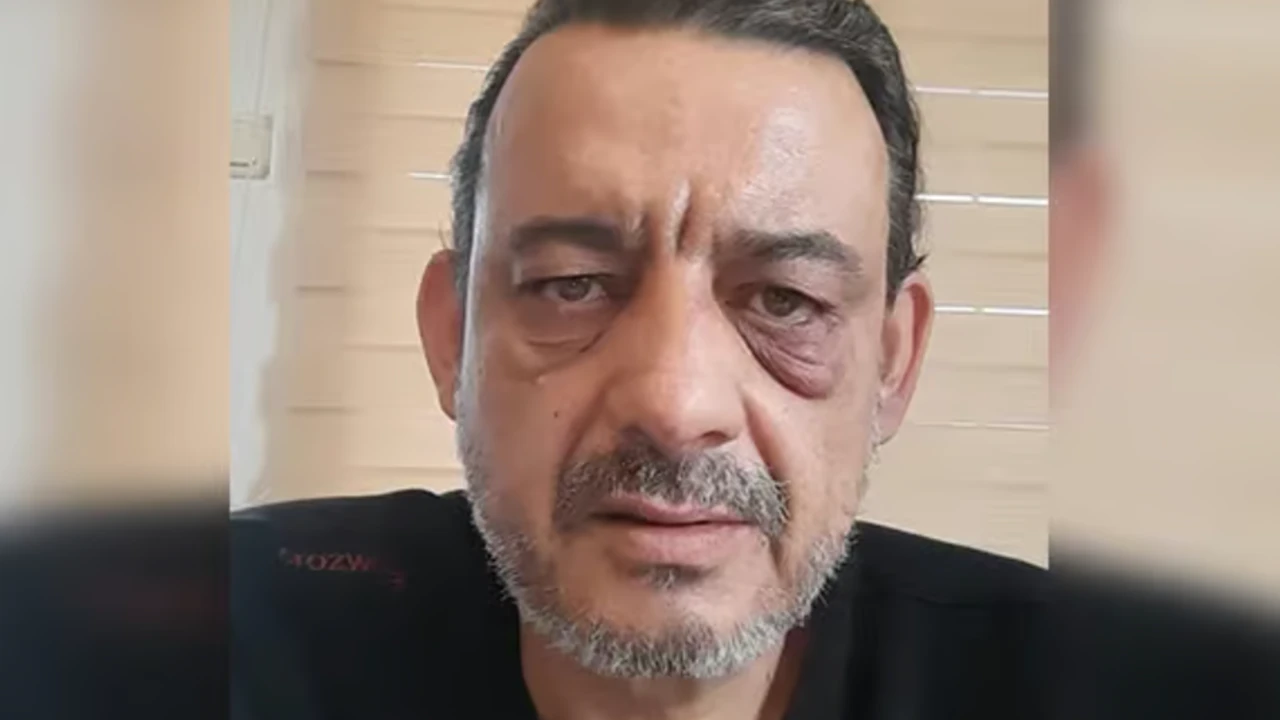 CHP'li Meclis üyesi, gazeteciye feci saldırdı! Kafasında şişe parçaladı