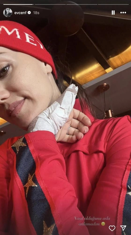 Fahriye Evcen kazada yaralandı