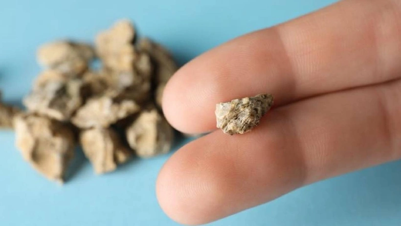 Erkeklerde daha fazla görülüyor: İdrarda kanama ve ağrıya dikkat!