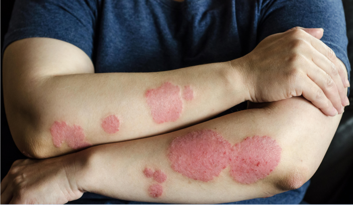 Kuduz hastalığı nedeniyle 9 yaşındaki Muhammed Muaz hayatını kaybetti