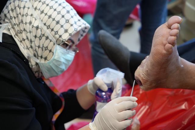 Samsun'da sinek larvasıyla yara tedavisi! Hastaların uzuvları kesilmekten kurtuluyor