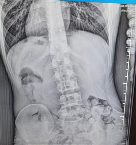 Samsun Çarşamba'da uyuşturucu operasyonu!