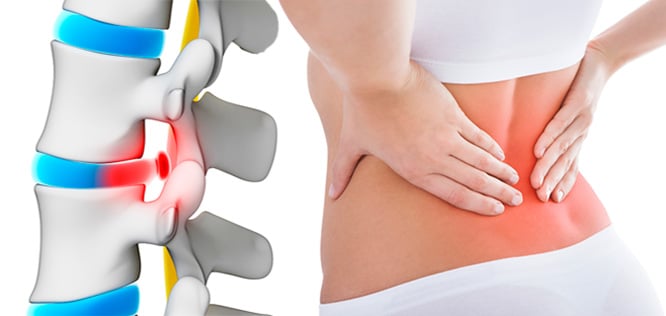 Sürekli bel ağrısı yaşayanlar dikkat! Bu rahatsızlık hem hastayı hem hekimi yanıltıyor