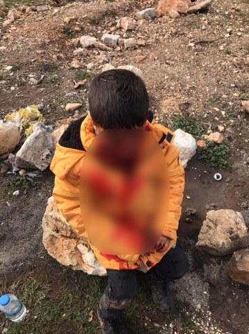 9 yaşındaki çocuk başıboş köpeklerin saldırısına uğradı! Ağır yaralandı