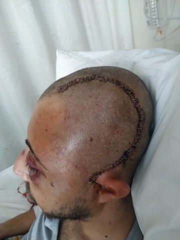 Patronundan dayak yiyen Nail Baran engelli kaldı