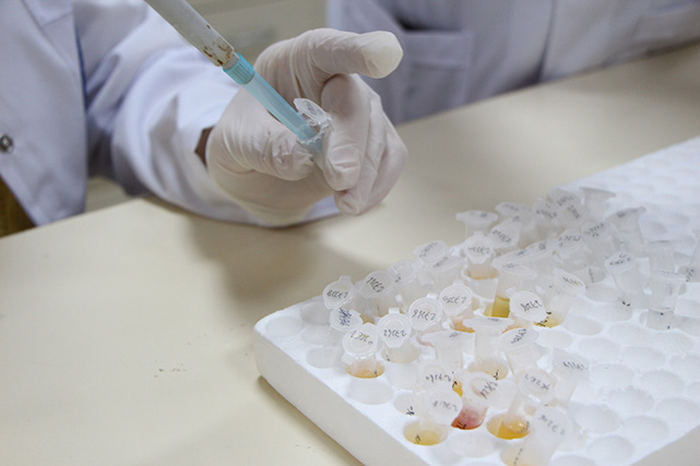 OMÜ Nöroimmunoloji Laboratuvarı Türkiye’nin en kapsamlı tanı merkezi