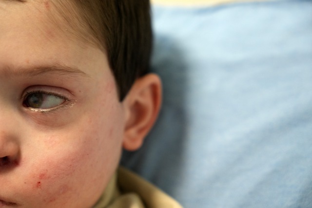 Akupunktur minik Burak'a umut oldu