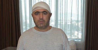 13 tane dişini çektirdi, acılarının nedeni bambaşka çıktı