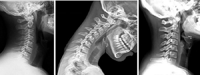 Cep telefonu bağımlılığınız sağlığınızı tehdit ediyor! Bunlara dikkat