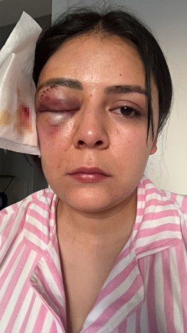 Genç kız yolda yürürken saldırıya uğradı! Korku dolu anları anlattı