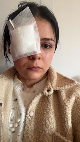 Genç kız yolda yürürken saldırıya uğradı! Korku dolu anları anlattı