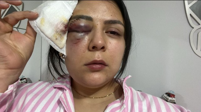 Genç kız yolda yürürken saldırıya uğradı! Korku dolu anları anlattı