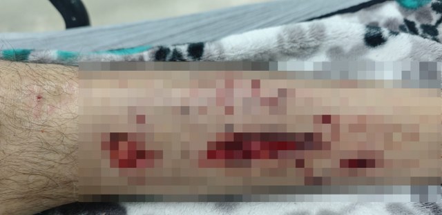 Köpekler dehşet saçtı!  Alzheimer hastasına saldırdılar