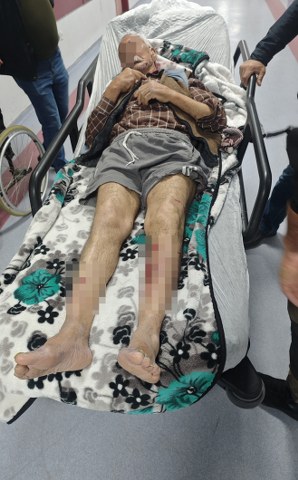 Köpekler dehşet saçtı!  Alzheimer hastasına saldırdılar