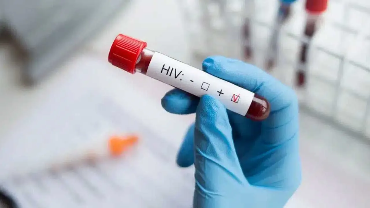 Türkiye’de yeni panik ‘AİDS’! Hızla artıyor artık çocuklar da tehlike altında