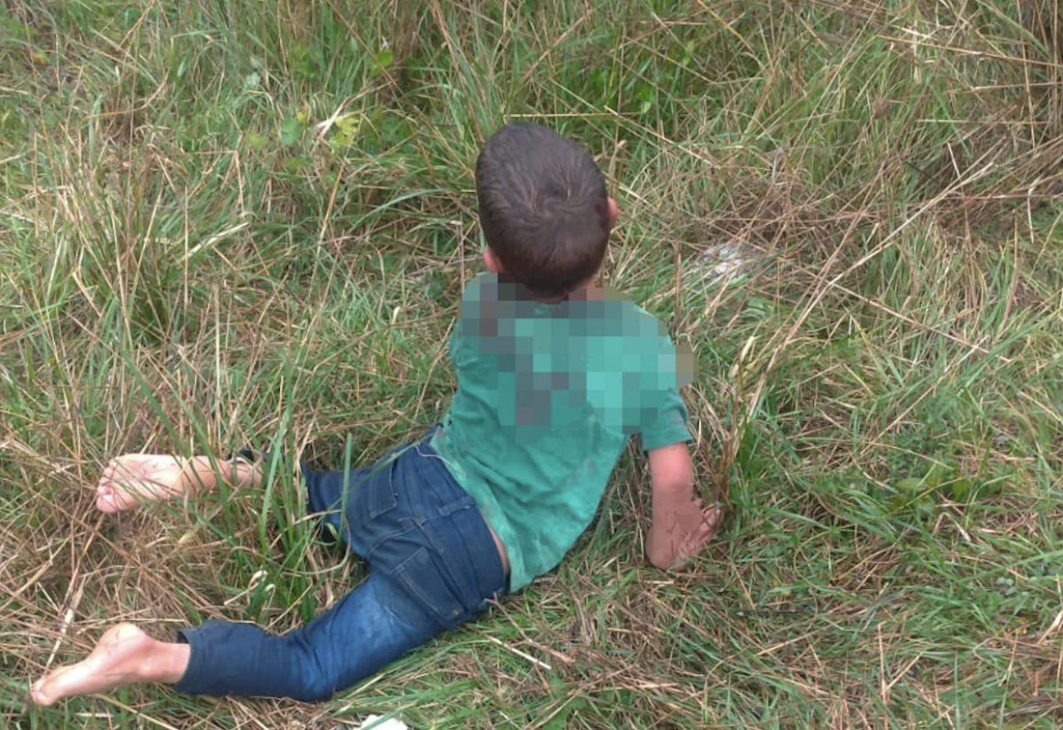 Yalova’da sokak köpeği 5 yaşındaki çocuğa saldırdı! Boğazından yaraladı, durumu ağır