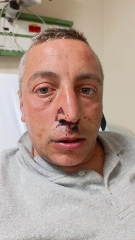 Engelli vatandaş yolda yürürken saldırıya uğradı