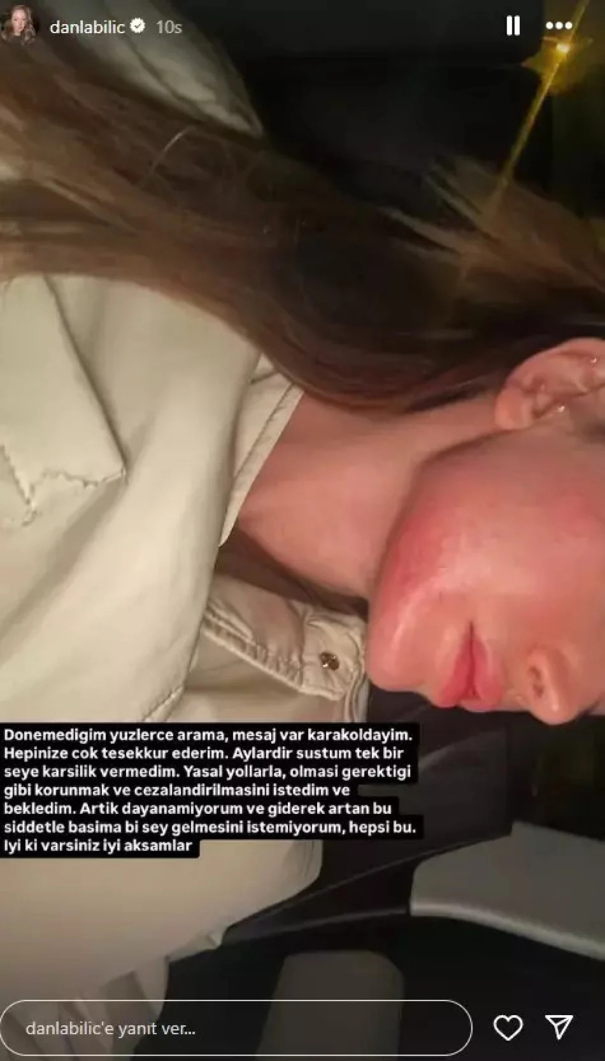 Eski sevgilisinden şiddet gören Danla Bilic, KADES'ten yardım çağırdı