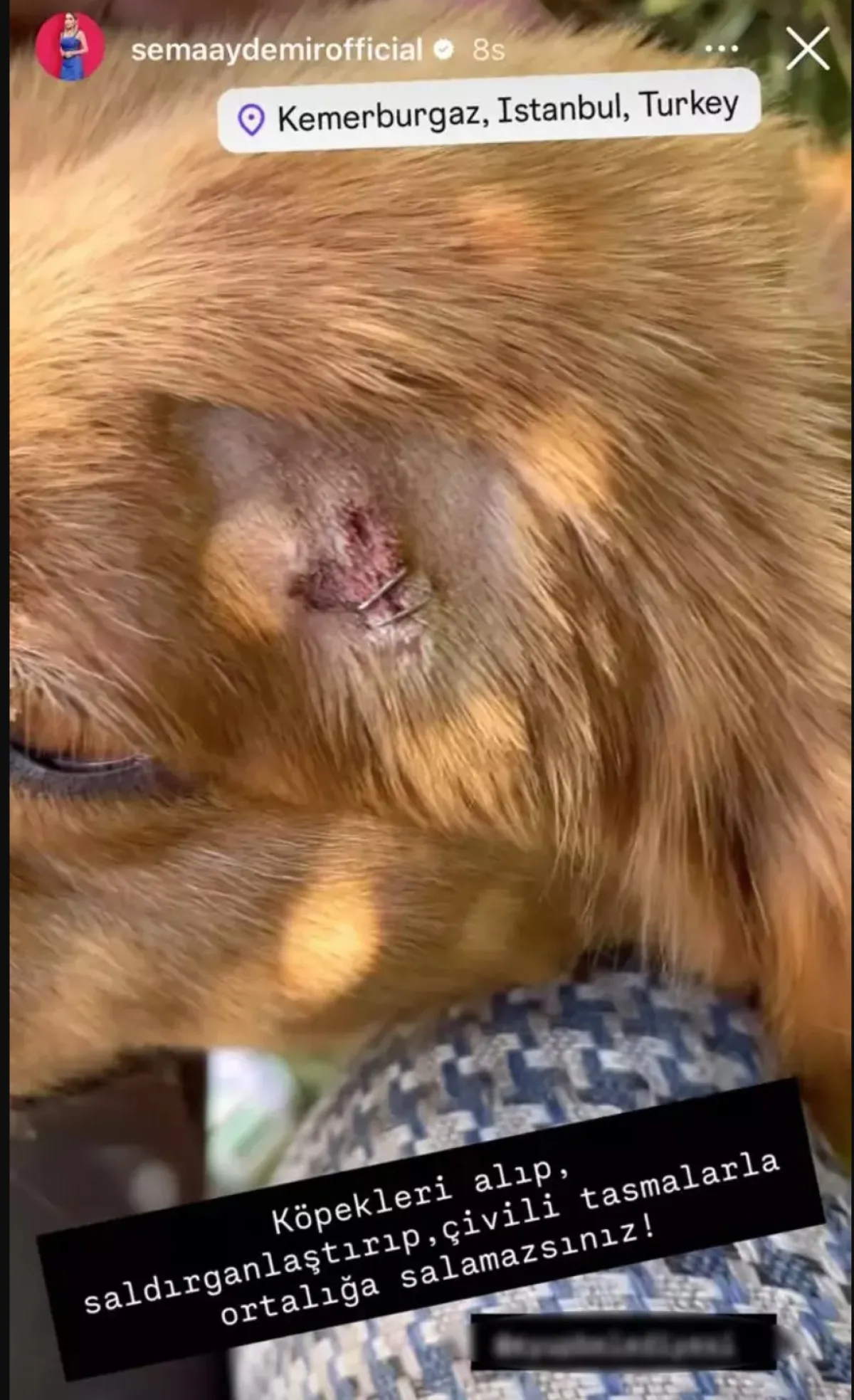 Survivor Sema’nın oğluna köpek saldırdı! “Sağ eli paramparça”