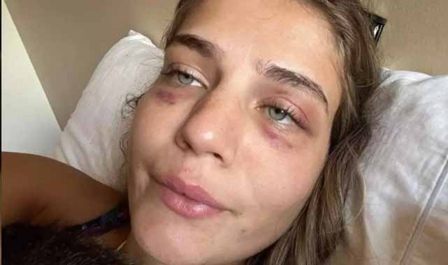 Brezilyalı model futbolcu sevgilisinden işkence gördüğünü duyurdu