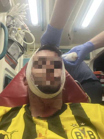 Samsun'da daire satışında kanlı kavga!