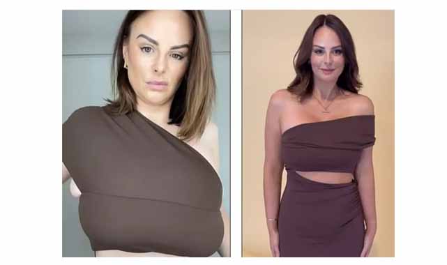 Ünlü model meme küçültme ameliyatı geçirdi!