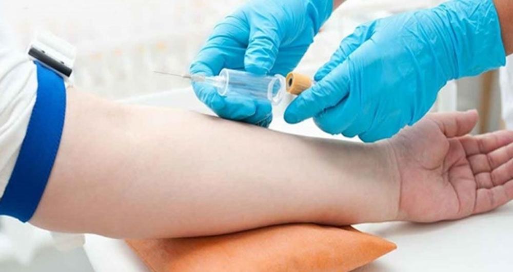 Sepsis her yıl 11 milyon insanı öldürüyor: İşte belirtiler ve korunma yolları