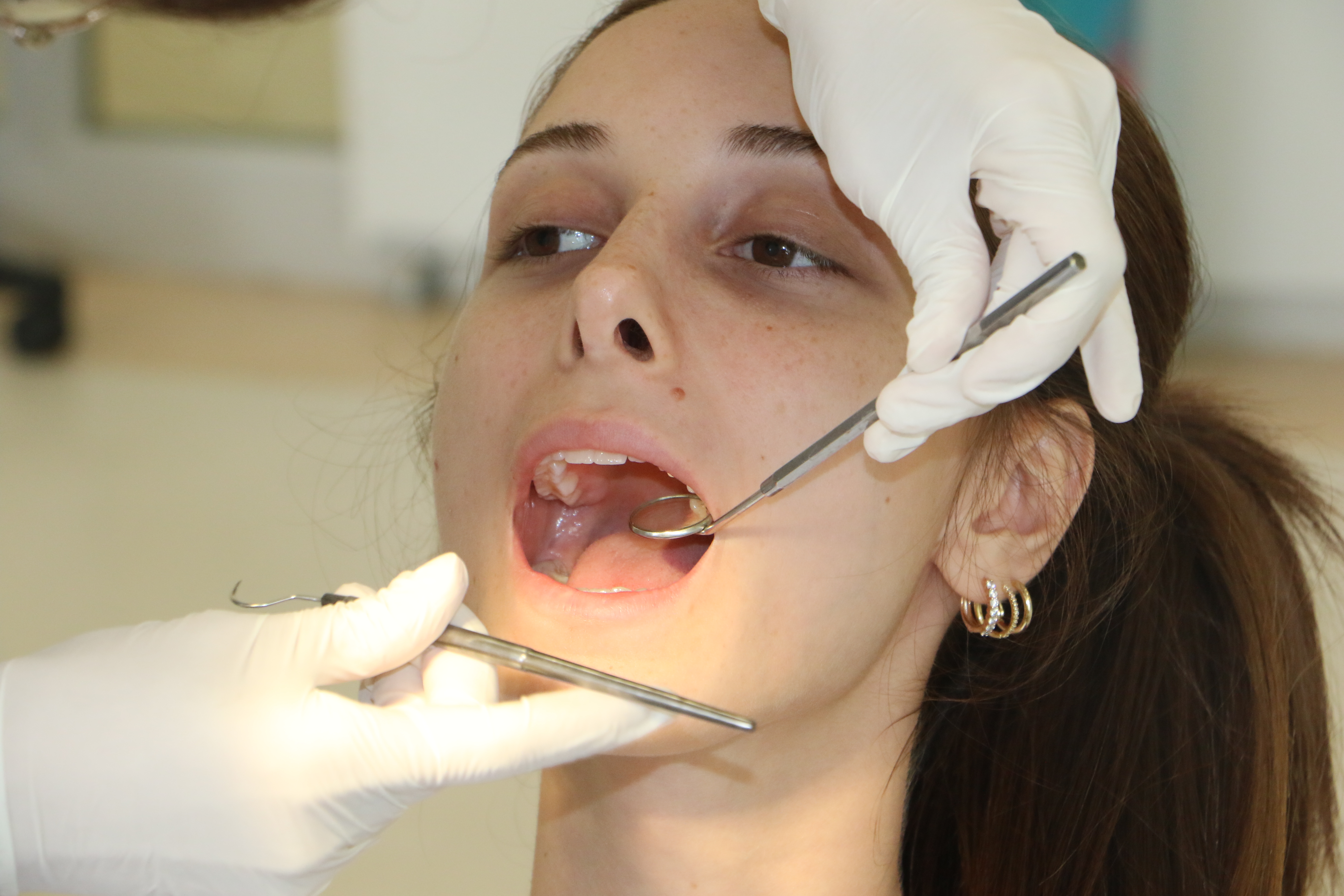 Samsun'da doktordan 2 haftadan uzun süren ağız yaraları için uyarı