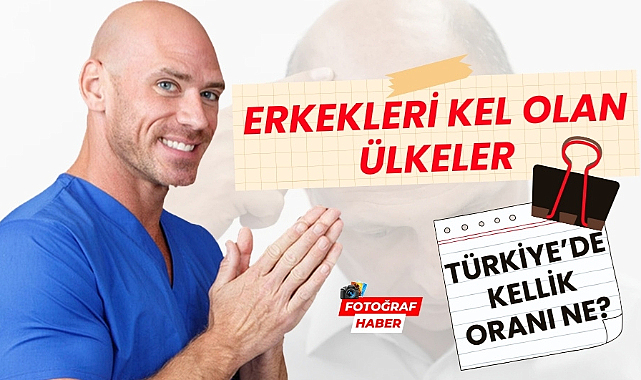 Erkekleri kel olan ülkeler Türkiye'de kellik oranı ne?