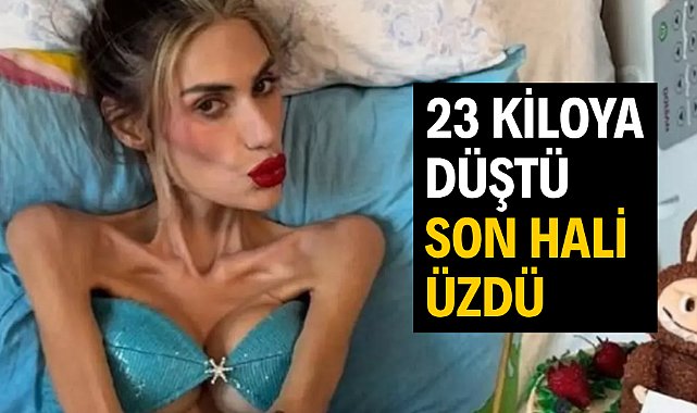 Nihal Candan 23 kiloya düştü! Son hali üzdü